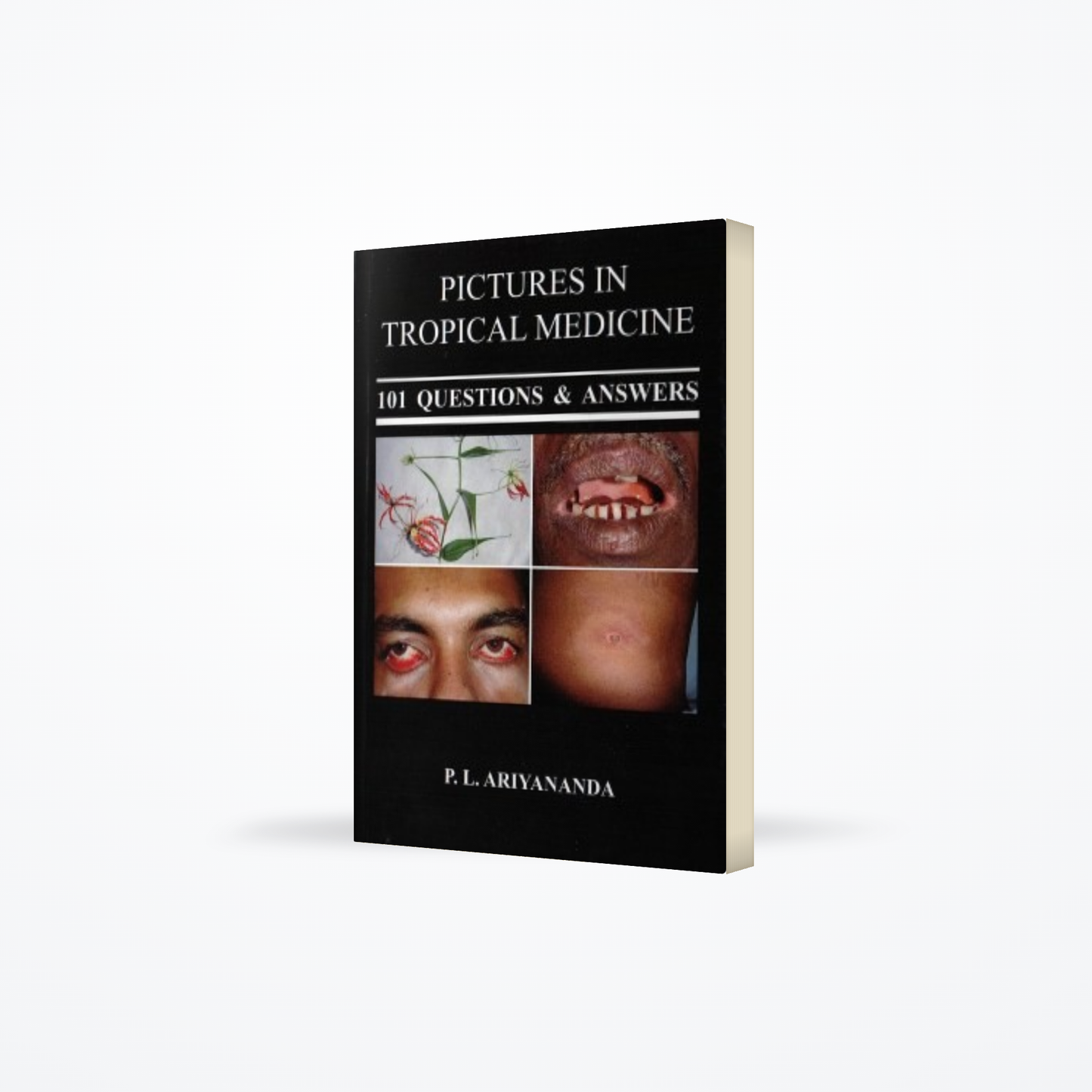 Pictures In Tropical Medicine : 101 Questions & Answers